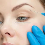 بوتاکس ابرو با نتیجه طبیعی در کرج